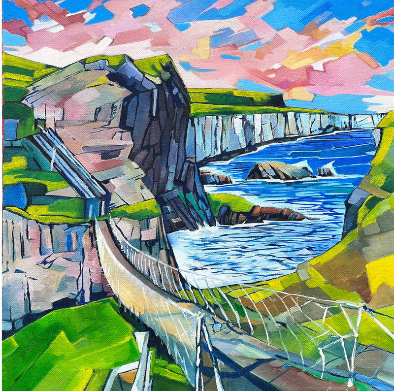 Carrick-a-Rede II Vibrant Giclée Print - Famous Irish Landmarks